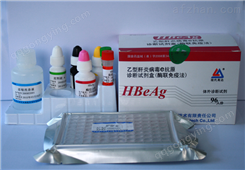 人热休克因子1（HSF-1）ELISA试剂盒
